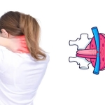 Ofis Çalışanları Dikkat! Bilgisayar Başında Saatler Boyunca Oturmak Boyun Fıtığına Davetiye