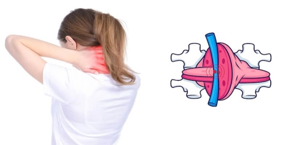 Ofis Çalışanları Dikkat! Bilgisayar Başında Saatler Boyunca Oturmak Boyun Fıtığına Davetiye