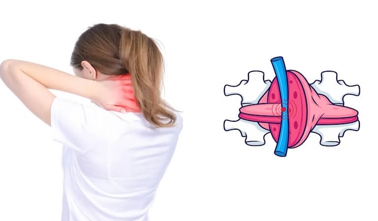 Ofis Çalışanları Dikkat! Bilgisayar Başında Saatler Boyunca Oturmak Boyun Fıtığına Davetiye